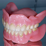 «за и против» зубных протезо
